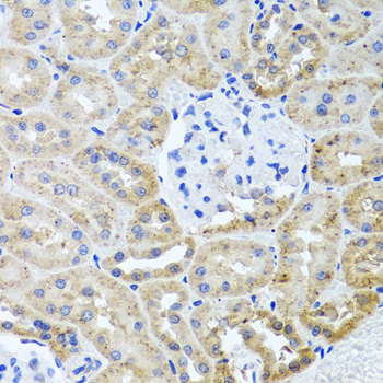 HDAC6 Rabbit polyclonal antibody