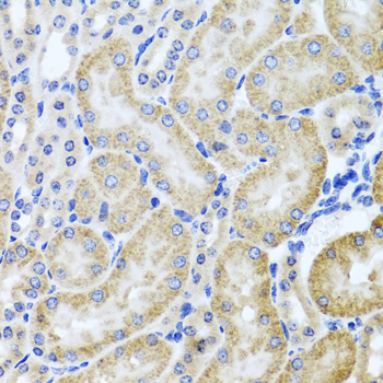 HDAC6 Rabbit polyclonal antibody