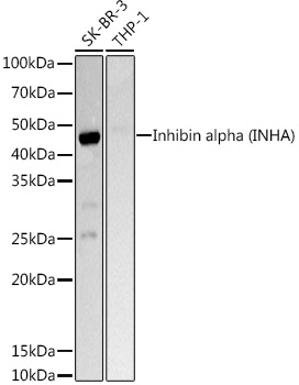 Inhibin alpha (INHA) Rabbit polyclonal antibody