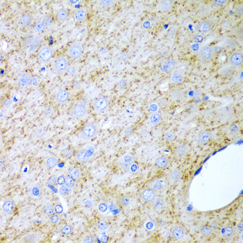Inhibin alpha (INHA) Rabbit polyclonal antibody