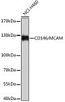 Western blot - CD146/MCAM Rabbit pAb (A17347)