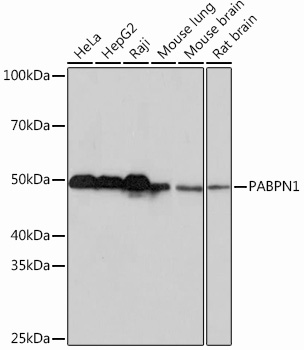 PABPN1 Rabbit monoclonal antibody