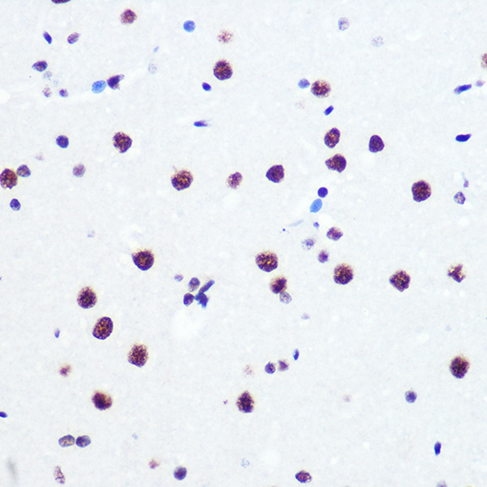 PABPN1 Rabbit monoclonal antibody