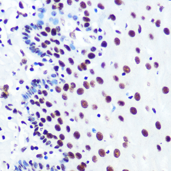 PABPN1 Rabbit monoclonal antibody
