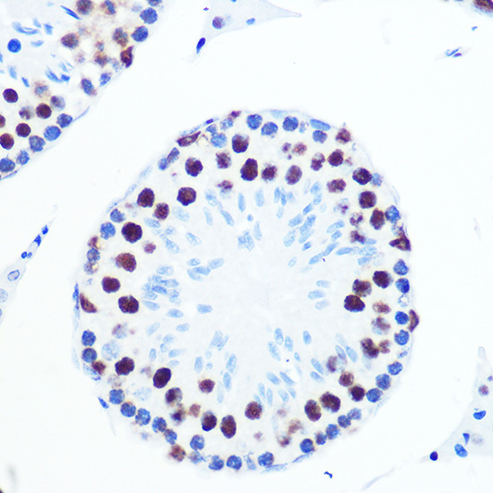 PABPN1 Rabbit monoclonal antibody