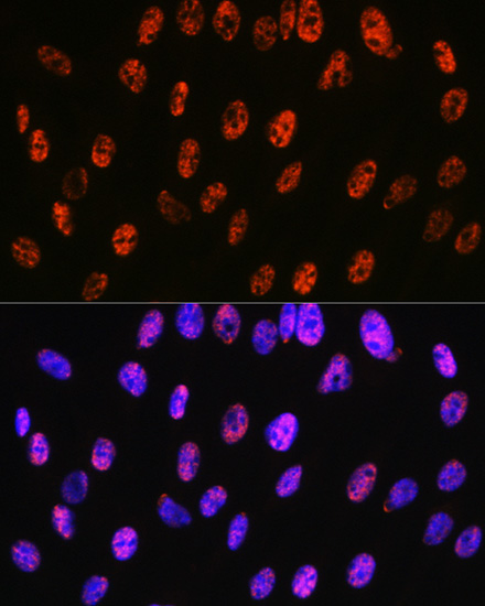 PABPN1 Rabbit monoclonal antibody