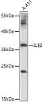 Western blot - IL1β Rabbit pAb (A17361)