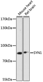 SYN1 Rabbit polyclonal antibody