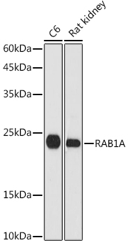 RAB1A Rabbit polyclonal antibody