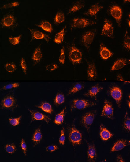 RAB1A Rabbit polyclonal antibody