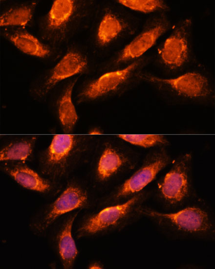 RAB1A Rabbit polyclonal antibody