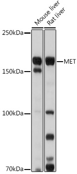 MET Rabbit polyclonal antibody