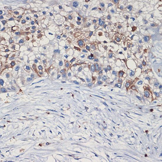 MET Rabbit polyclonal antibody