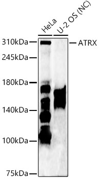 ATRX Rabbit polyclonal antibody