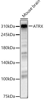 ATRX Rabbit polyclonal antibody