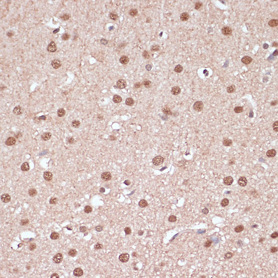 ITCH Rabbit polyclonal antibody