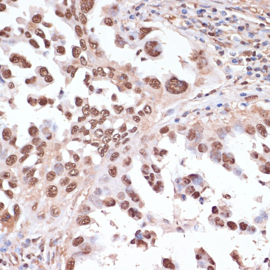 ITCH Rabbit polyclonal antibody