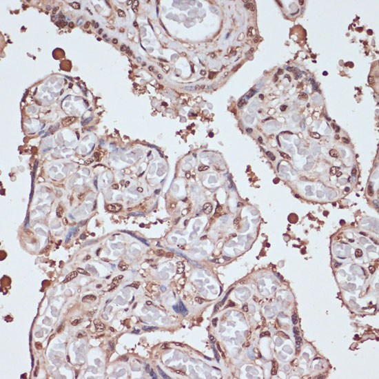ITCH Rabbit polyclonal antibody