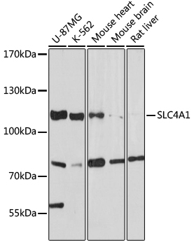 SLC4A1 Rabbit polyclonal antibody
