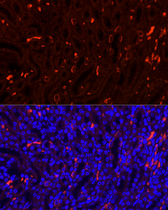 SLC4A1 Rabbit polyclonal antibody