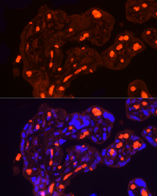 SLC4A1 Rabbit polyclonal antibody