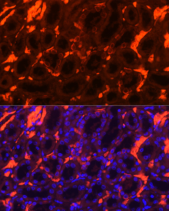 SLC4A1 Rabbit polyclonal antibody