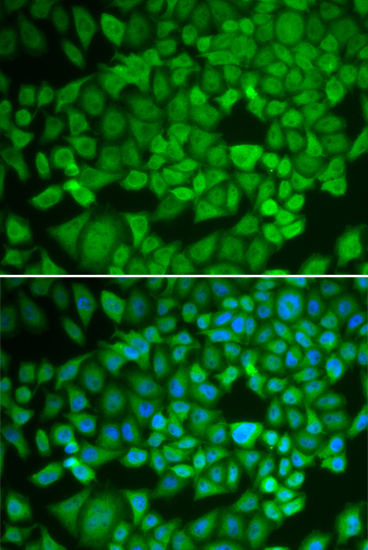 NR0B1 Rabbit polyclonal antibody