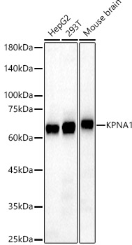 KPNA1 Rabbit polyclonal antibody