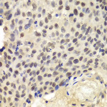KPNA1 Rabbit polyclonal antibody