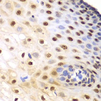 KPNA1 Rabbit polyclonal antibody