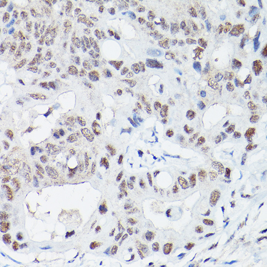 DNA Ligase IV Rabbit polyclonal antibody