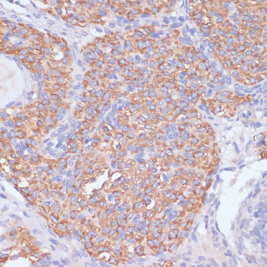 PI3 Kinase p85 beta Rabbit polyclonal antibody