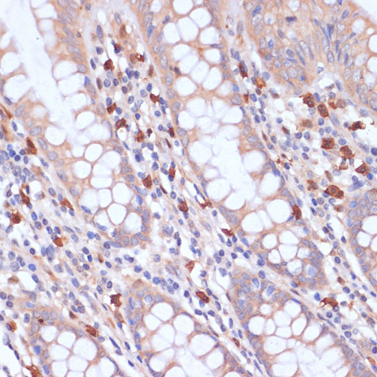 PI3 Kinase p85 beta Rabbit polyclonal antibody
