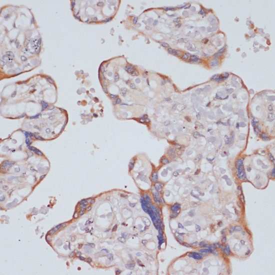 PI3 Kinase p85 beta Rabbit polyclonal antibody