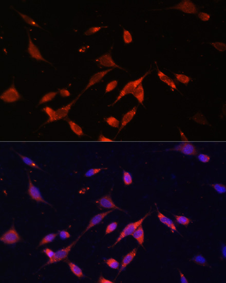 PI3 Kinase p85 beta Rabbit polyclonal antibody
