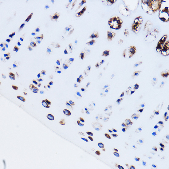 PTH1R Rabbit polyclonal antibody