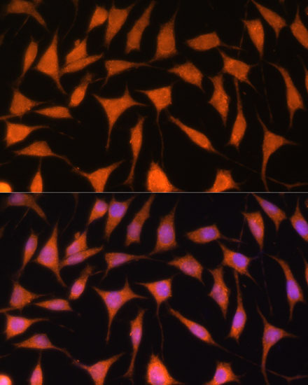 TIMM44 Rabbit polyclonal antibody