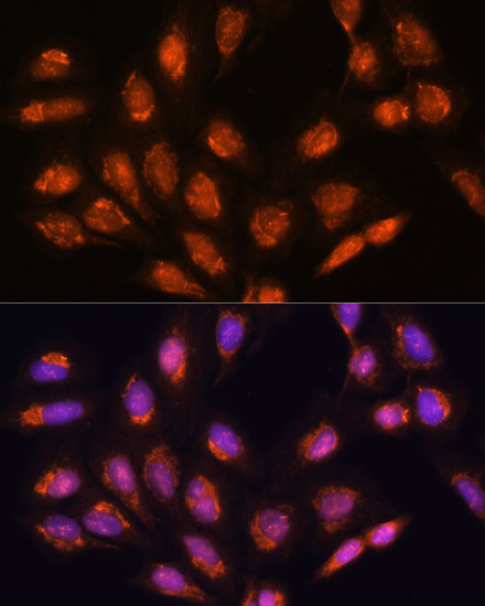 TIMM44 Rabbit polyclonal antibody