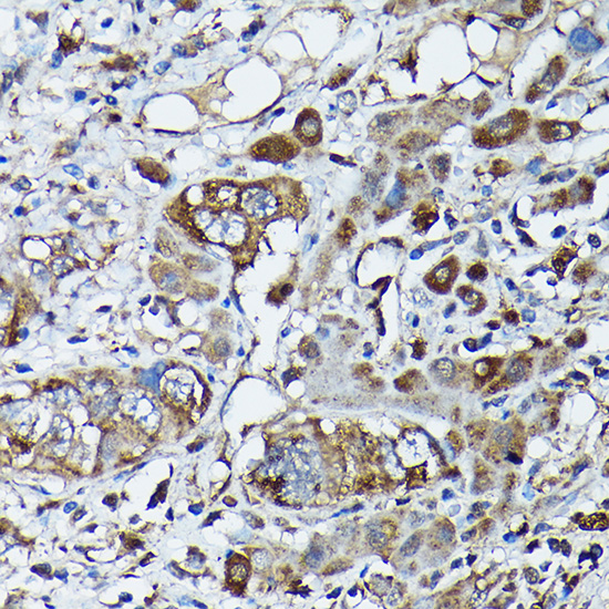 FXN / Frataxin Rabbit polyclonal antibody