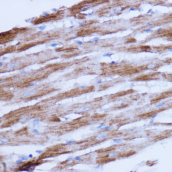 NDUFB9 Rabbit polyclonal antibody