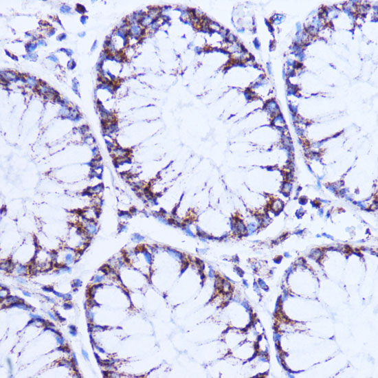 NDUFB9 Rabbit polyclonal antibody