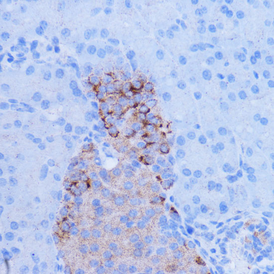 NDUFB9 Rabbit polyclonal antibody