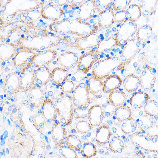 PDXP Rabbit polyclonal antibody