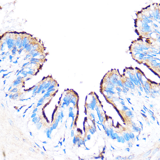 PDXP Rabbit polyclonal antibody