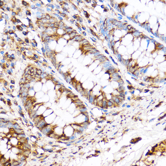 PDXP Rabbit polyclonal antibody