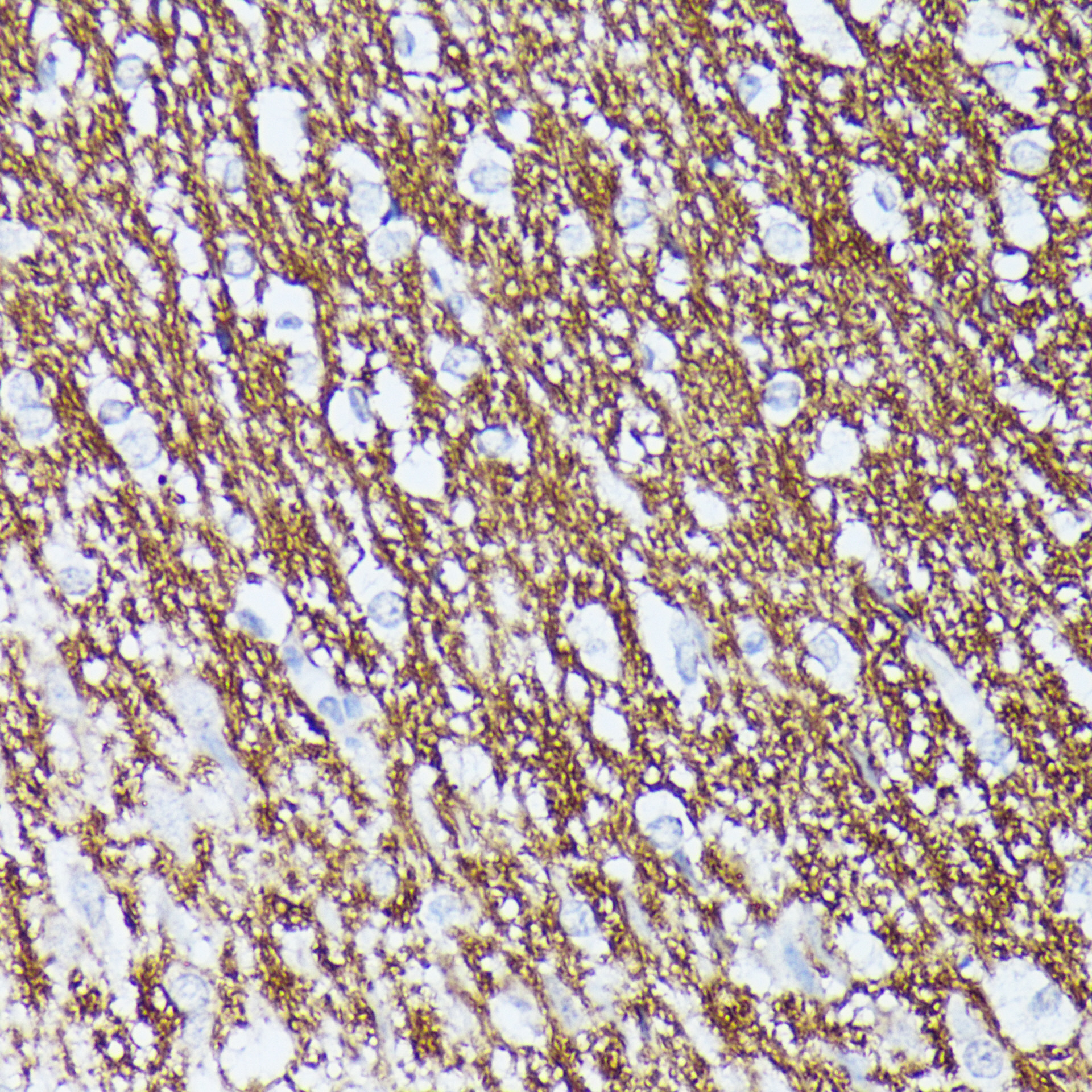 CNTN1 Rabbit polyclonal antibody