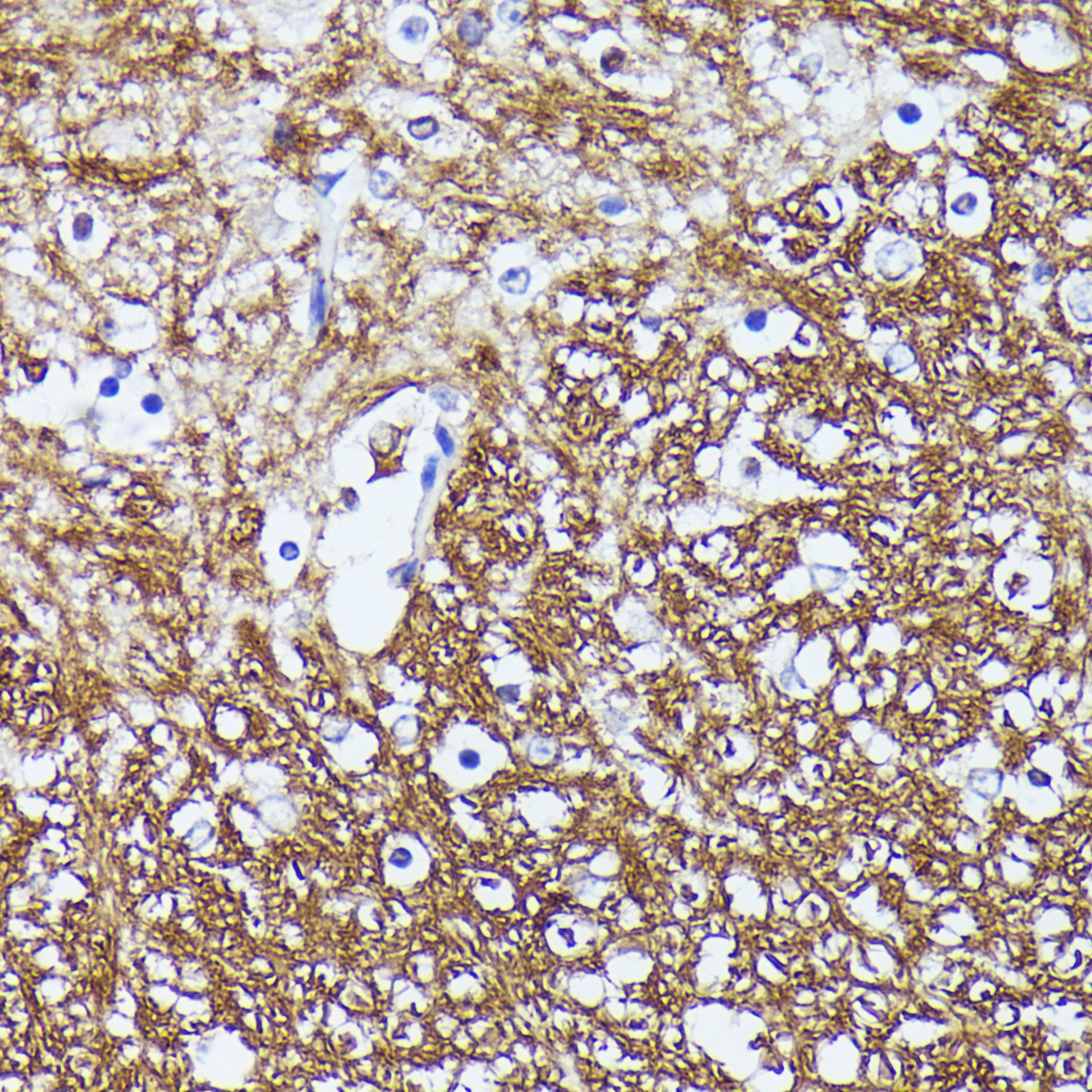 CNTN1 Rabbit polyclonal antibody