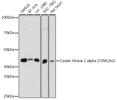 Casein Kinase 2 alpha (CSNK2A1) Rabbit pAb