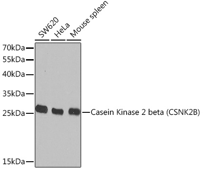 Casein Kinase 2 beta (CSNK2B) Rabbit polyclonal antibody