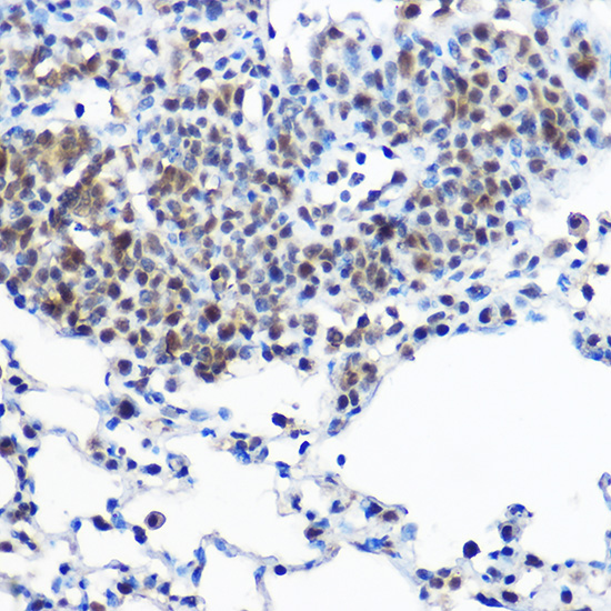 Casein Kinase 2 beta (CSNK2B) Rabbit polyclonal antibody